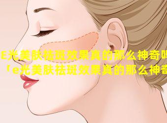 E光美肤祛斑效果真的那么神奇吗「e光美肤祛斑效果真的那么神奇吗 🌾 知乎」